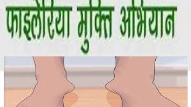 राजिम और छुरा क्षेत्र में 27 फरवरी से 13 मार्च तक चलेगा फाइलेरिया उन्मूलन कार्यक्रम राजिम और छुरा क्षेत्र में 27 फरवरी से 13 मार्च तक चलेगा फाइलेरिया उन्मूलन कार्यक्रम