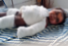 CG News: खेलते समय मोबाइल की बैटरी ब्लास्ट, मासूम की मौत:चेहरा, सीना-पेट और हाथ बुरी तरह झुलसा, कहीं से पुरानी बैटरी उठा ले आए थे बच्चे