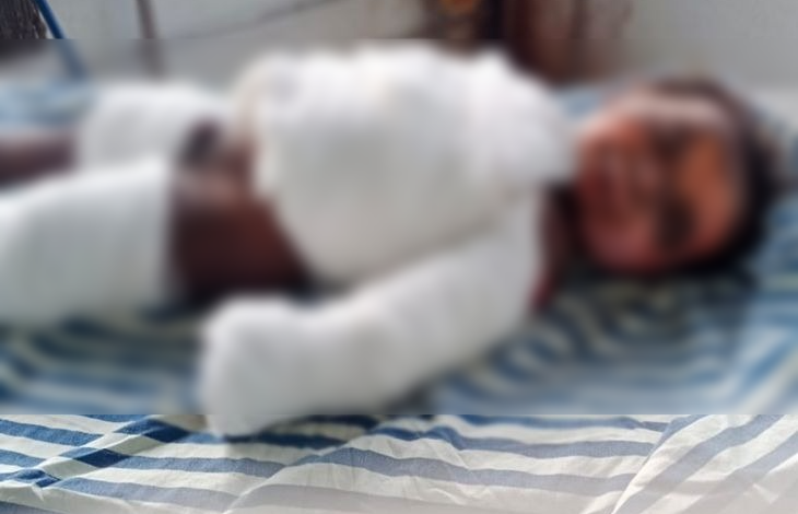 CG News: खेलते समय मोबाइल की बैटरी ब्लास्ट, मासूम की मौत:चेहरा, सीना-पेट और हाथ बुरी तरह झुलसा, कहीं से पुरानी बैटरी उठा ले आए थे बच्चे