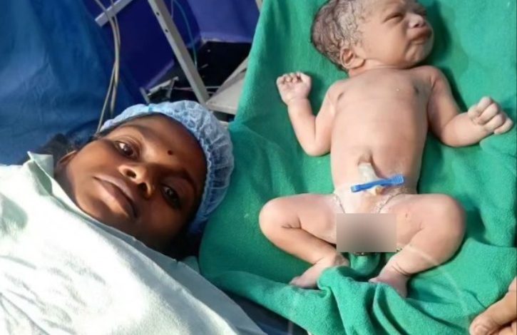 डिलीवरी के समय ऑपरेशन थिएटर में गाया भरथरी, स्वस्थ बच्चे को जन्म दिया