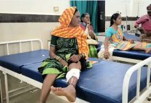 CG News: आवारा कुत्ते ने 13 लोगों को काटा, तीन की हालत गंभीर