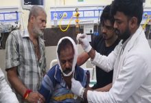 ज्वेलर्स के सिक्योरिटी गार्ड पर चापड़ से हमला: बेटे ने की गांजा पीने की शिकायत, नाराज युवक ने पिता पर किया जानलेवा हमला