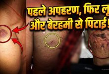 रायपुर में आकर नाबालिग का अपहरण! लूट और बेरहमी से पिटाई, जबड़े में 3 जगह फ्रैक्चर, 10 युवकों पर आरोप रायपुर में आकर नाबालिग का अपहरण! लूट और बेरहमी से पिटाई, जबड़े में 3 जगह फ्रैक्चर, 10 युवकों पर आरोप